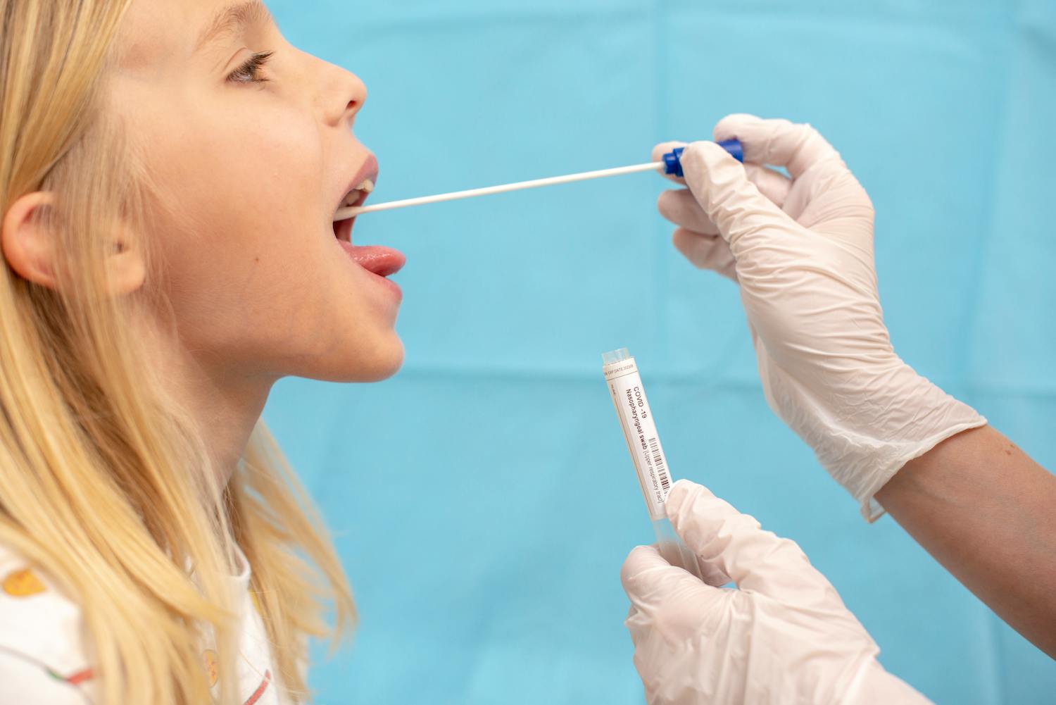 Qu'est-ce qu'une angine de Vincent ?