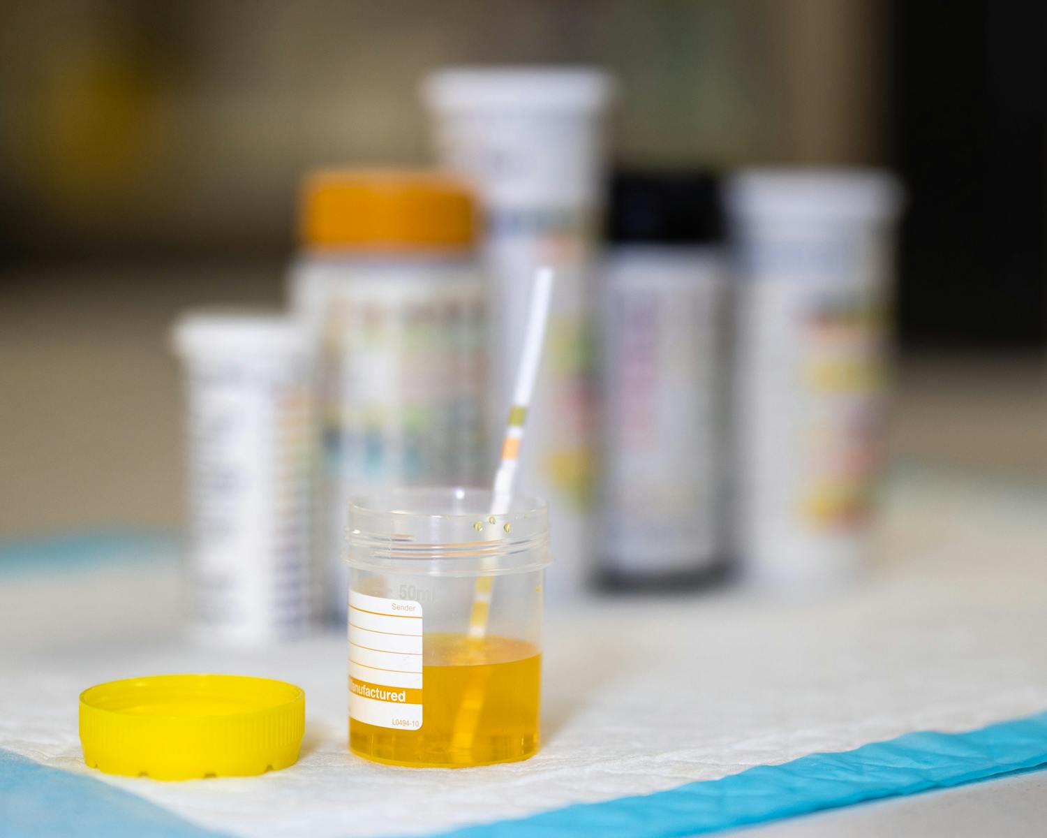 Cystite : les tests à domicile sont-ils fiables?